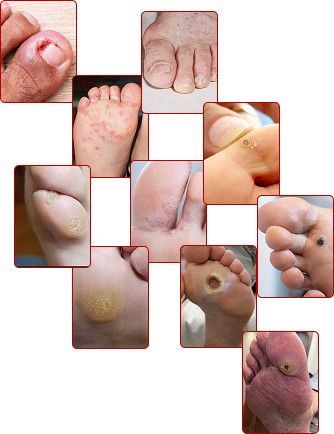 Atendimento profissional em podologia